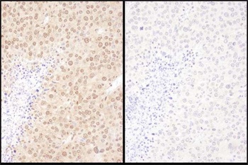 Rabbit WWOX Antibody