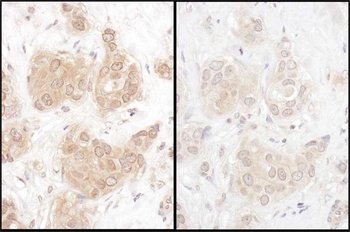 Rabbit WWOX Antibody