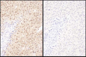 Rabbit WWOX Antibody