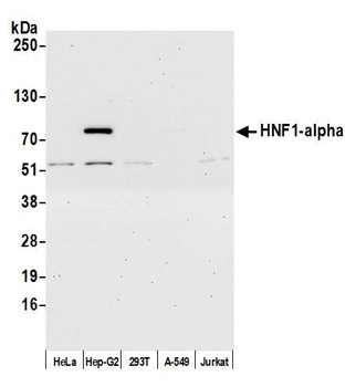 Rabbit HNF1-alpha Antibody