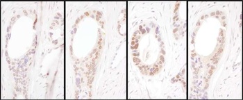 Rabbit HNF1-alpha Antibody