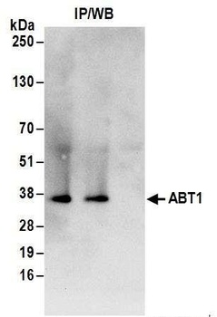 Rabbit ABT1 Antibody
