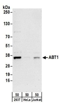 Rabbit ABT1 Antibody