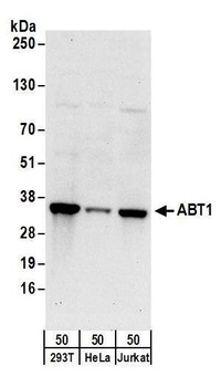 Rabbit ABT1 Antibody