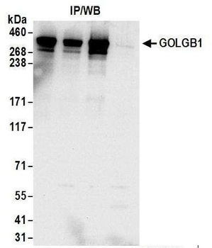 Rabbit GOLGB1 Antibody
