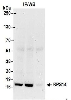 Rabbit RPS14 Antibody