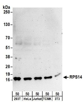Rabbit RPS14 Antibody