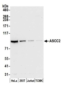Rabbit ASCC2 Antibody