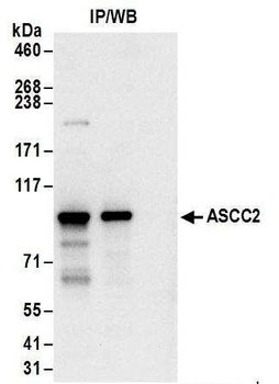 Rabbit ASCC2 Antibody