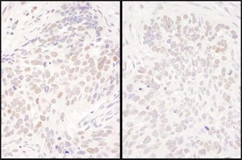 Rabbit DENTT Antibody