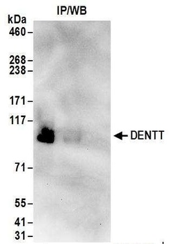 Rabbit DENTT Antibody
