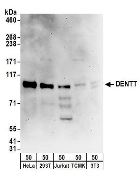 Rabbit DENTT Antibody