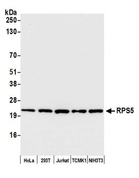 Rabbit RPS5 Antibody