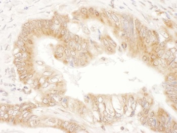 Rabbit CaMKK2 Antibody