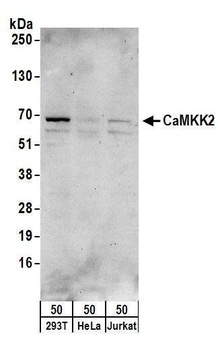 Rabbit CaMKK2 Antibody