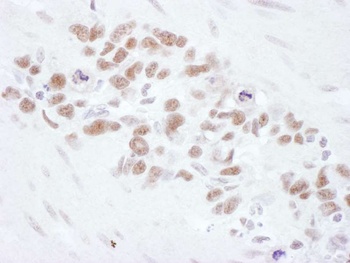 Rabbit Mre11 Antibody