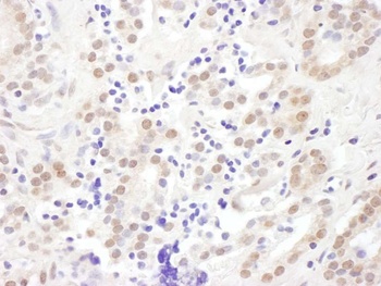 Rabbit EXOSC10 Antibody