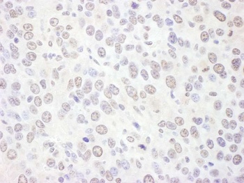 Rabbit EXOSC10 Antibody