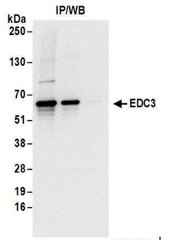 Rabbit EDC3 Antibody