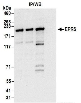 Rabbit EPRS Antibody