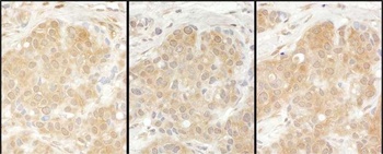 Rabbit EPRS Antibody