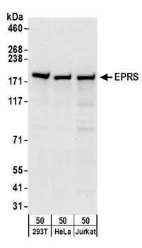 Rabbit EPRS Antibody