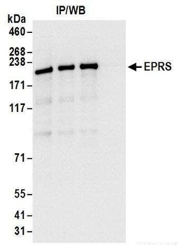 Rabbit EPRS Antibody