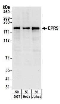 Rabbit EPRS Antibody