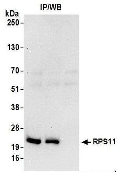 Rabbit RPS11 Antibody