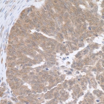 Rabbit RPL5 Antibody
