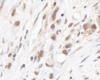 Rabbit RPL5 Antibody