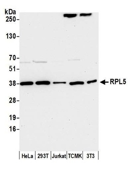 Rabbit RPL5 Antibody