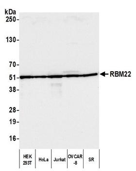 Rabbit anti-RBM22 Antibody