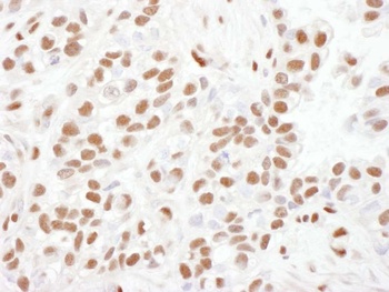 Goat 53BP1 Antibody