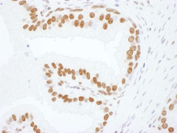 Rabbit hnRNP-L Antibody