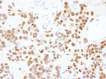 Rabbit hnRNP-L Antibody