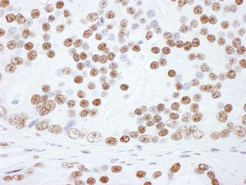 Rabbit hnRNP-L Antibody