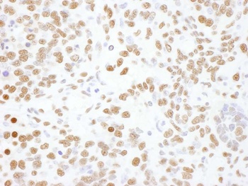 Rabbit hnRNP-L Antibody