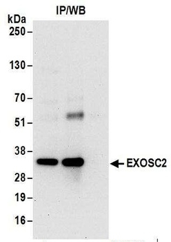 Rabbit EXOSC2 Antibody