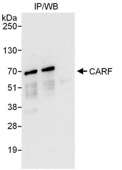 Rabbit CARF Antibody