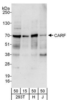 Rabbit CARF Antibody