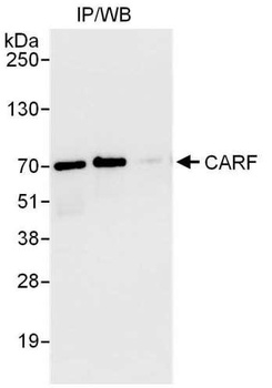 Rabbit CARF Antibody