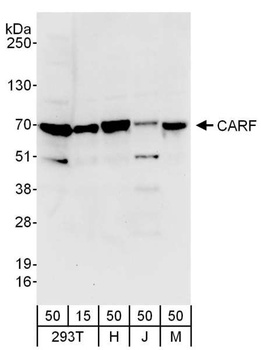 Rabbit CARF Antibody