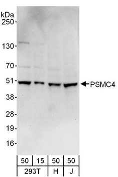 Rabbit PSMC4 Antibody