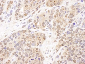 Rabbit PSMB7 Antibody