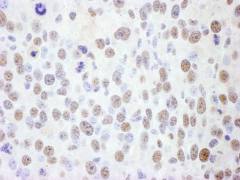 Goat SMC1 Antibody