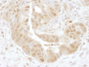 Rabbit PSMD7 Antibody