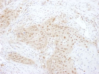 Rabbit PSMD7 Antibody