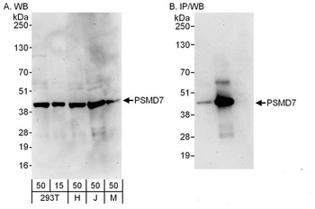 Rabbit PSMD7 Antibody