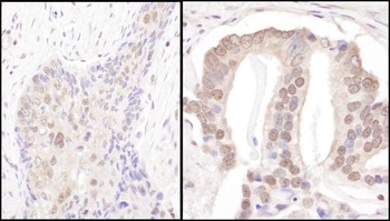 Rabbit PSMD3 Antibody